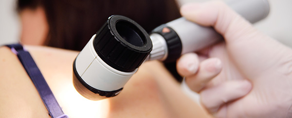 Skin Cancer Misdiagnosis Lawsuit